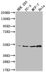 AHCY Recombinant Monoclonal Antibody [13H8]