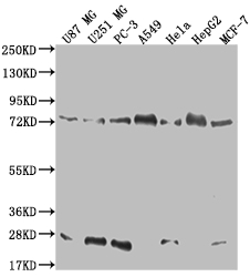 CAPN2 Recombinant Monoclonal Antibody [17E9]