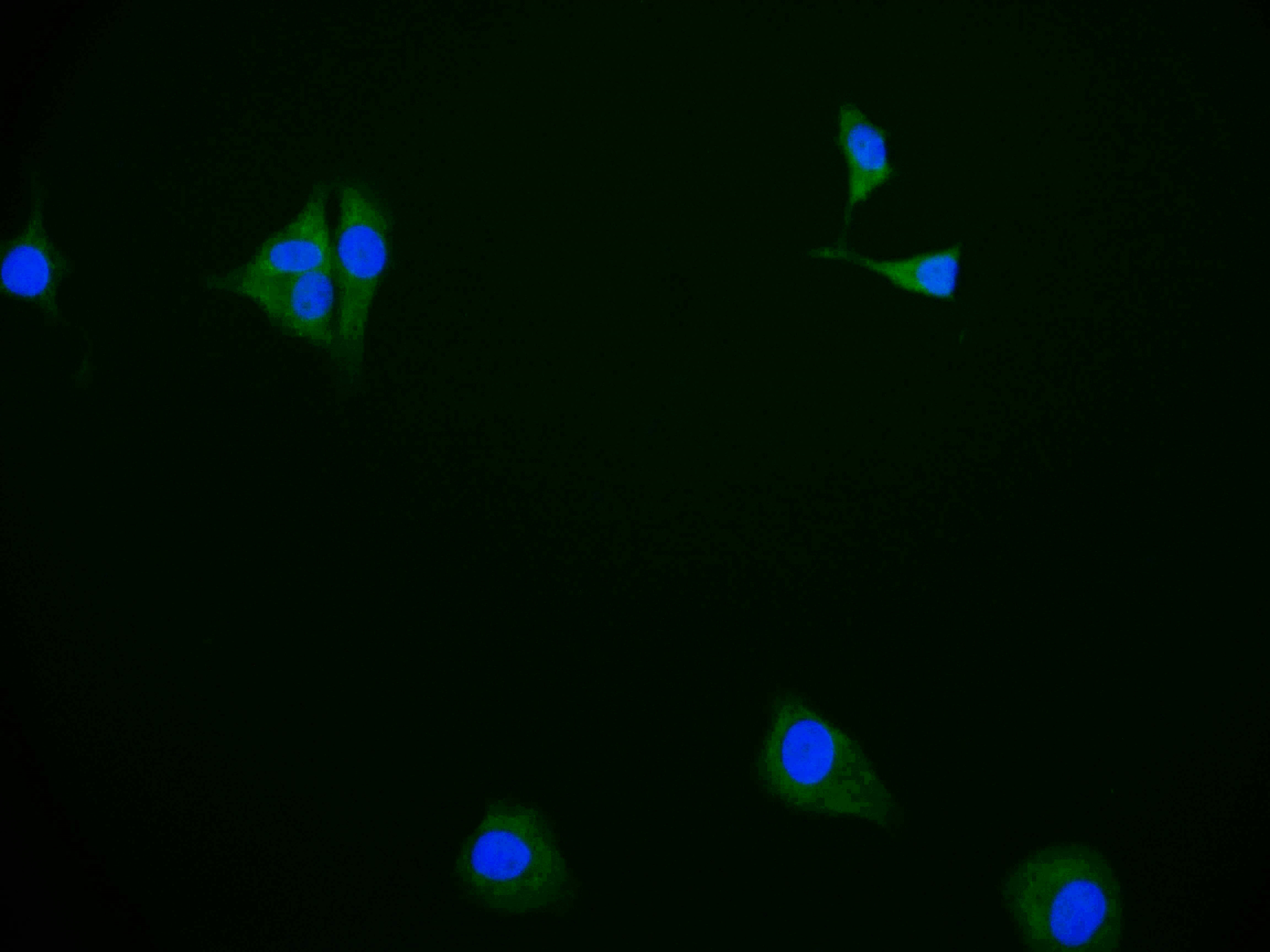 ABCB1 Recombinant Monoclonal Antibody [11H10] (50µl)