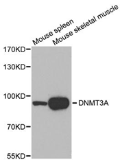 Western blot analysis of extracts of various tissues, using DNMT3A Polyclonal Antibody.