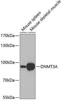 DNMT3A Polyclonal Antibody (50 µl)