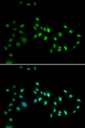 Immunofluorescence analysis of A549 cell using DNMT3A Polyclonal Antibody. Blue: DAPI for nuclear staining.