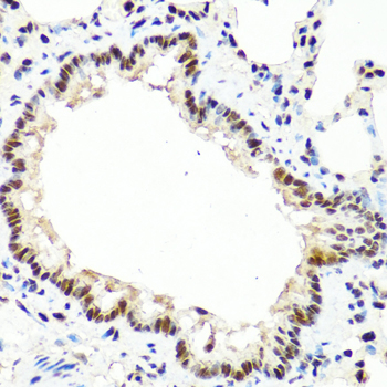 TET2 Polyclonal Antibody (100 µl)