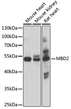 MBD2 Polyclonal Antibody (100 µl)