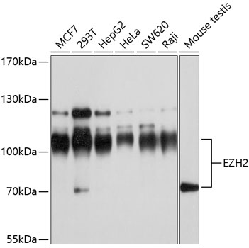 EZH2 Polyclonal Antibody (100 µl)