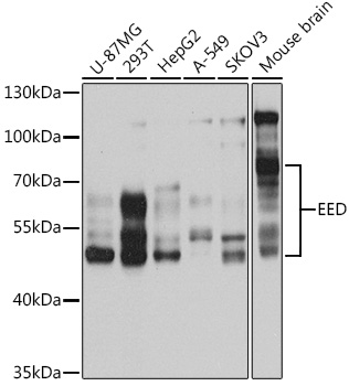 EED Polyclonal Antibody (100 µl)