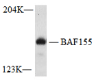 WB analysis of BAF155 Monoclonal Antibody with HaLa cell lysates (A-2027).