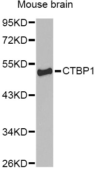 Western blot analysis of extracts of various cell lines, using CTBP1 Polyclonal Antibody.