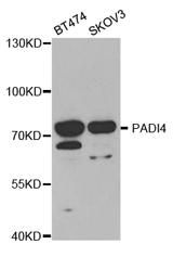Western blot analysis of extracts of various cell lines, using PADI4 Polyclonal Antibody