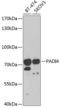 PADI4 Polyclonal Antibody (100 µl)