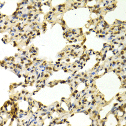 Immunohistochemistry of paraffin-embedded rat lung using PADI4 Polyclonal Antibody at dilution of 1:100 (x40 lens).