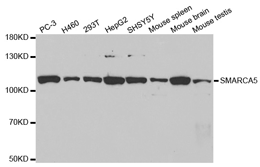 Western blot analysis of extracts of various cell lines, using SMARCA5 Polyclonal Antibody.