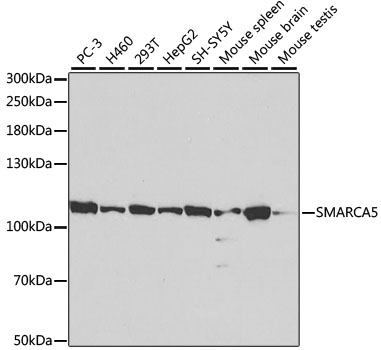 SMARCA5 Polyclonal Antibody (100 µl)