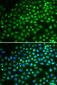 Immunofluorescence analysis of HeLa cell using SMARCA5 Polyclonal Antibody. Blue: DAPI for nuclear staining.