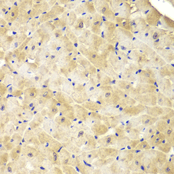 Immunohistochemistry of paraffin-embedded mouse heart using IDH1 Polyclonal Antibody at dilution of 1:100 (400x lens).