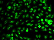 Immunofluorescence analysis of HeLa cell using IDH1 Polyclonal Antibody.