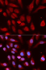 Immunofluorescence analysis of U20S cell using UHRF1 Polyclonal Antibody. Blue: DAPI for nuclear staining.
