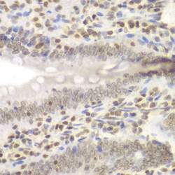 Immunohistochemistry of paraffin-embedded rat Intestine using UHRF2 Polyclonal Antibody at dilution of 1:200 (400x lens).