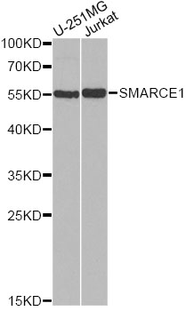 Western blot analysis of extracts of various cell lines, using SMARCE1 Polyclonal Antibody.
