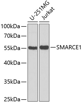 SMARCE1 Polyclonal Antibody (100 µl)