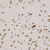 Immunohistochemistry of paraffin-embedded mouse brain using SMARCE1 Polyclonal Antibody at dilution of 1:200 (x400 lens).