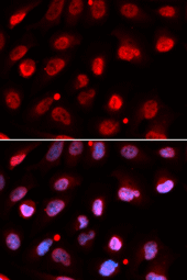 Immunofluorescence analysis of U20S cell using RNF2 antibody. Blue: DAPI for nuclear staining.