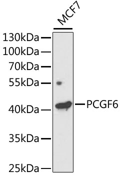 PCGF6 Polyclonal Antibody (100 µl)
