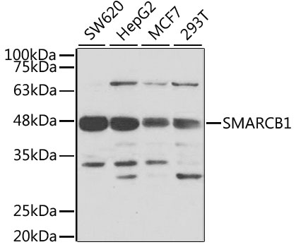 Western blot analysis of extracts of various cell lines, using SMARCB1 Polyclonal Antibody.