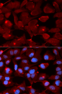 Immunofluorescence analysis of U20S cell using SMARCB1 Polyclonal Antibody. Blue: DAPI for nuclear staining.