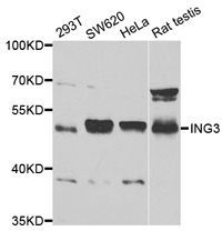 Western blot analysis of extracts of various cell lines, using ING3 Polyclonal Antibody.