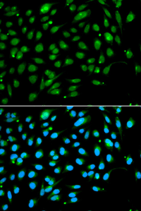 Immunofluorescence analysis of A549 cell using ING3 Polyclonal Antibody. Blue: DAPI for nuclear staining.
