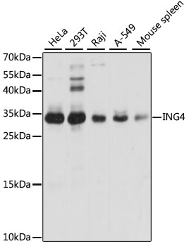 Western blot analysis of extracts of various cell lines, using ING4 Polyclonal Antibody.