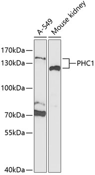 PHC1 Polyclonal Antibody (100 µl)