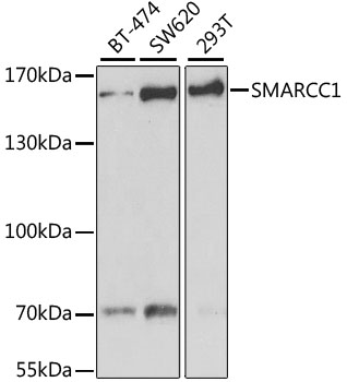 SMARCC1 Polyclonal Antibody (50 µl)