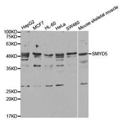 Western blot analysis of extracts of various cell lines, using SMYD5 Polyclonal Antibody.