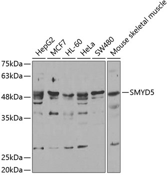 SMYD5 Polyclonal Antibody (100 µl)