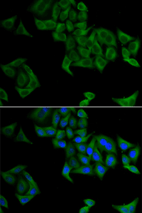 Immunofluorescence analysis of A549 cell using SMYD5 Polyclonal Antibody. Blue: DAPI for nuclear staining.