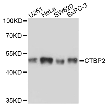 Western blot analysis of extracts of various cell lines, using CTBP2 Polyclonal Antibody at 1:3000 dilution. <br>Secondary antibody: HRP Goat Anti-Rabbit IgG (H+L) (AS014) at 1:10000 dilution.<br>Lysates/proteins: 25ug per lane.<br>