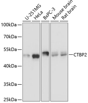 CTBP2 Polyclonal Antibody (50 µl)