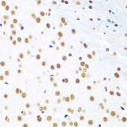 Immunohistochemistry of paraffin-embedded mouse brain using  CTCF Polyclonal Antibody  at dilution of 1:100 (40x lens).