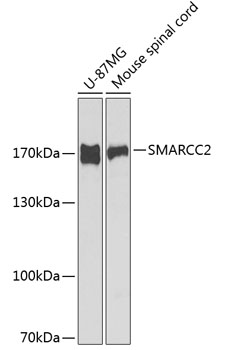 SMARCC2 Polyclonal Antibody (100 µl)