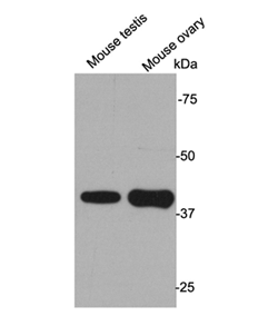 Western blot analysis on tissue  lysates using  L1ORF1p polyclonal antibody.