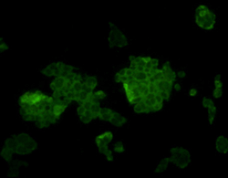 ICC staining L1ORF1p in F9 cells (green). Cells  were fixed in paraformaldehyde, permeabilised with  0.25% Triton X100/PBS.
