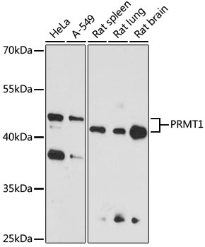 PRMT1 Polyclonal Antibody (50 µl)