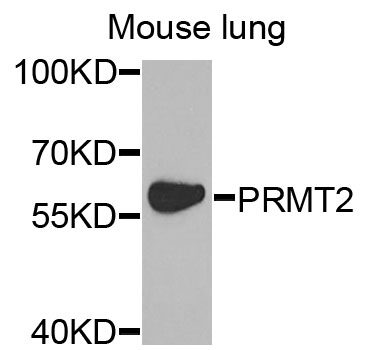 Western blot analysis of extracts of mouse lung cells, using PRMT2 Polyclonal Antibody.