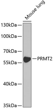 PRMT2 Polyclonal Antibody (50 µl)