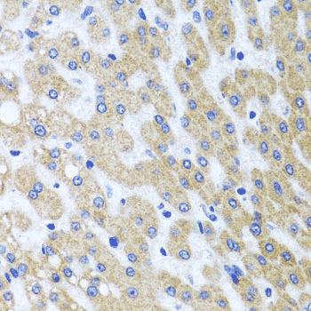 mmunohistochemistry of paraffin-embedded human liver injury using  PRMT2 Polyclonal Antibody  at dilution of 1:100 (x40 lens).