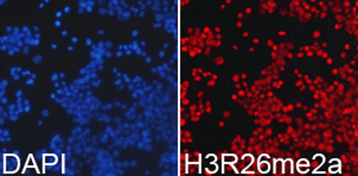 Immunofluorescence analysis of 293T cell using Histone H3R26 Dimethyl Asymmetric (H3R26me2a) Polyclonal Antibody. Blue: DAPI for nuclear staining.