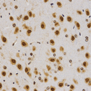 Immunohistochemistry - Histone H4R3 Dimethyl Asymmetric (H4R3me2a) Polyclonal Antibody