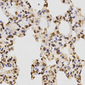 Immunohistochemistry of paraffin-embedded rat lung tissue using Histone H3R17 Dimethyl Asymmetric (H3R17me2a) Polyclonal Antibody at dilution of 1:200 (x400 lens).